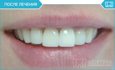 до і після установки