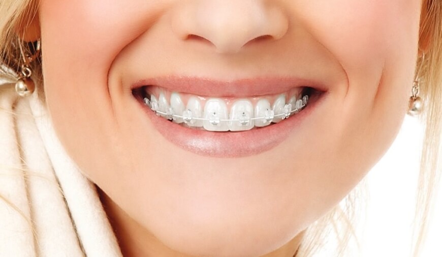 chto-luchshe-nosit-brekety-ili-elajnery-4