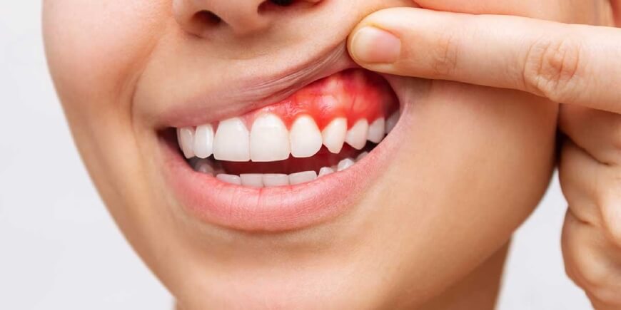 absczess-zuba-vidy-prichiny-simptomy-i-lechenie