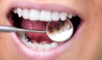 Lingual-Braces